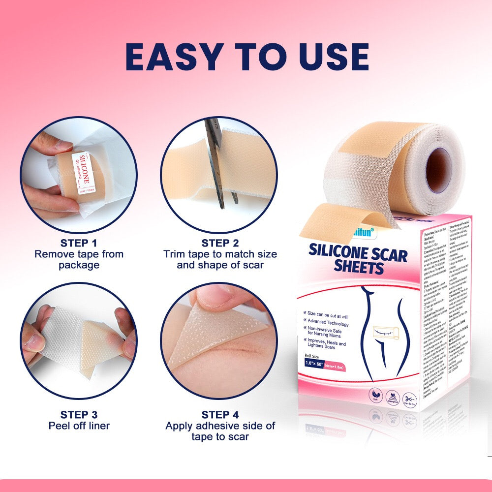 Silicone Scar Sheets (4*150cm, Brown color) | Scar Repair Tapes for New & Old Scars and Stretch Marks