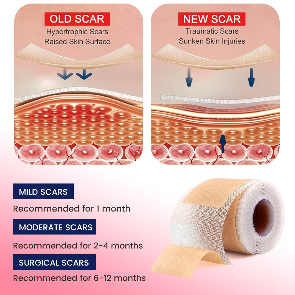 Silicone Scar Sheets (4*150cm, Brown color) | Scar Repair Tapes for New & Old Scars and Stretch Marks