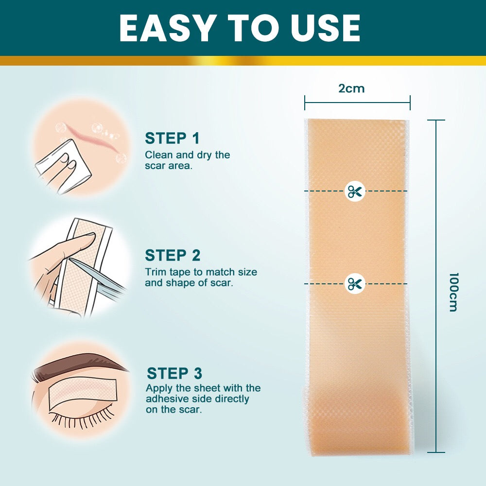 Silicone Scar Sheets (4*150cm, Brown color) | Scar Repair Tapes for New & Old Scars and Stretch Marks