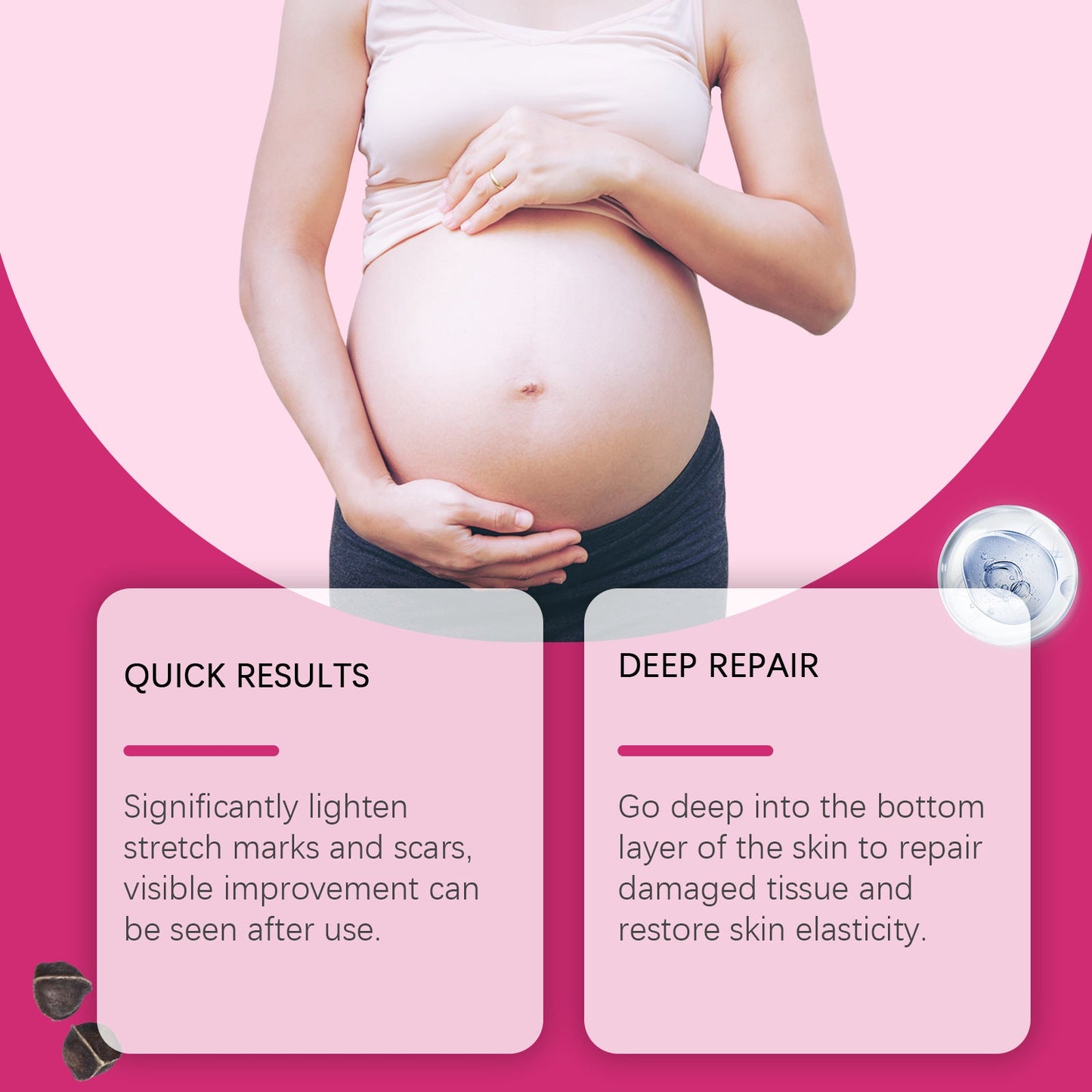 BIYODE Stretch Mark Oil (100ml) | Topical Oil for Scars, Stretch Marks, and Skin Elasticity