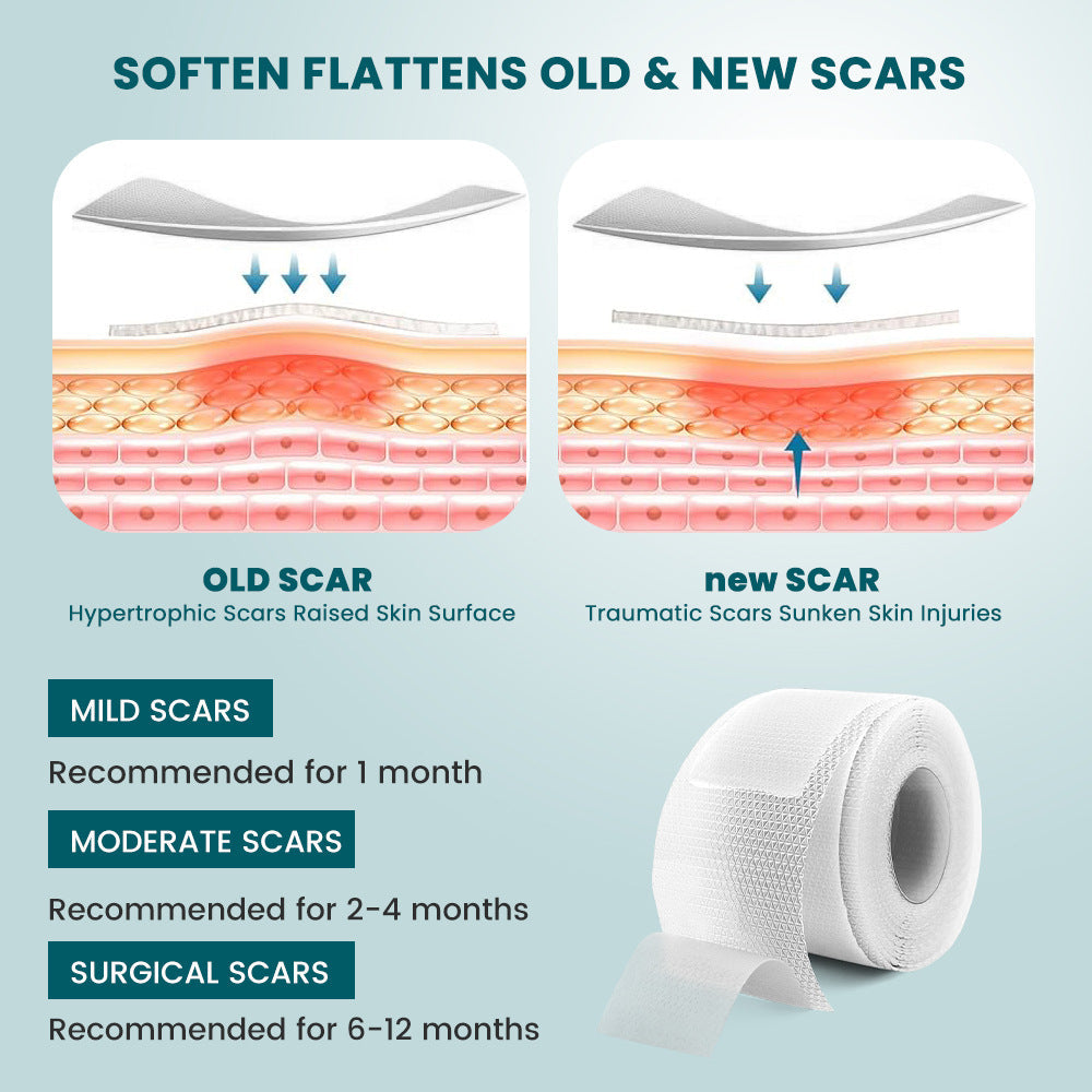 Silicone Scar Tape (2×100cm, White color) | Scar Repair Sheet for New & Old Scars and Stretch Marks