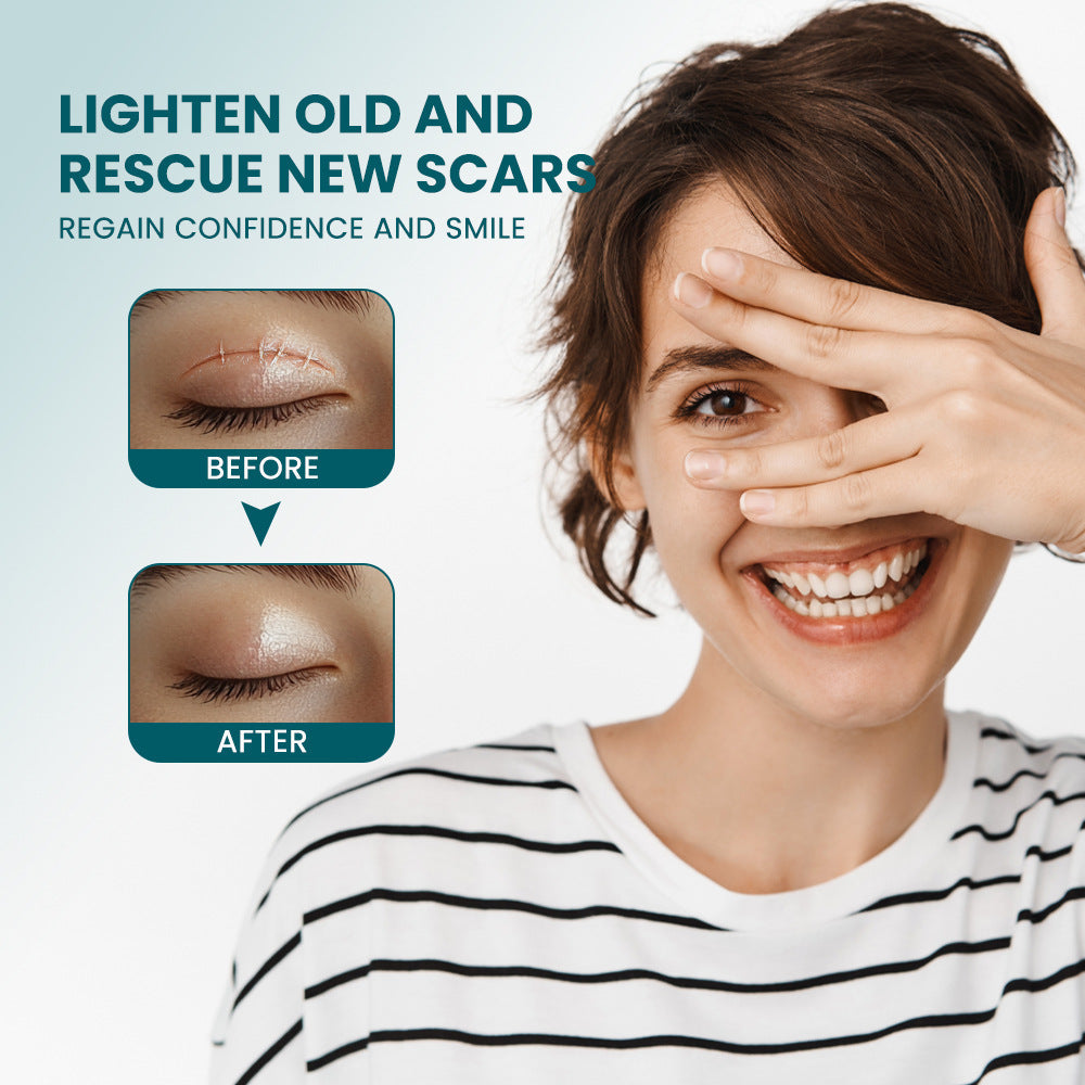 Silicone Scar Tape (2×100cm, White color) | Scar Repair Sheet for New & Old Scars and Stretch Marks