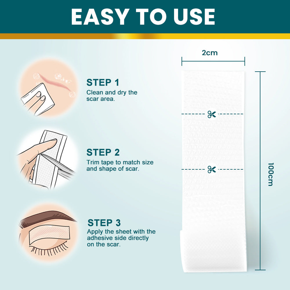Silicone Scar Tape (2×100cm, White color) | Scar Repair Sheet for New & Old Scars and Stretch Marks