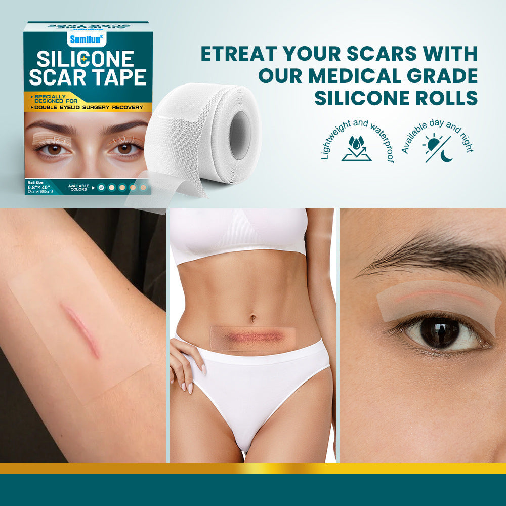 Silicone Scar Tape (2×100cm, White color) | Scar Repair Sheet for New & Old Scars and Stretch Marks